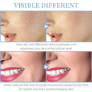 Aparelho redutor de rugas portátil bivolt. Beleza em alta frequência